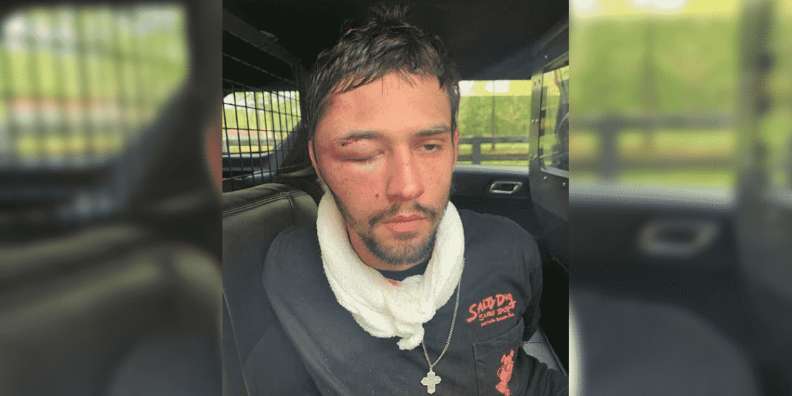 Homeowner Stops Burglary, Fires Warning Shots, Chases Down & Badly Beats Suspect