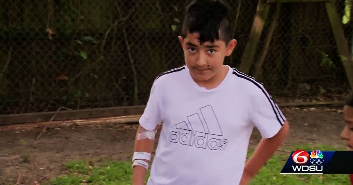 PSA Stop Shooting Guns in the Air; 10YearOld Hit By Falling Bullet