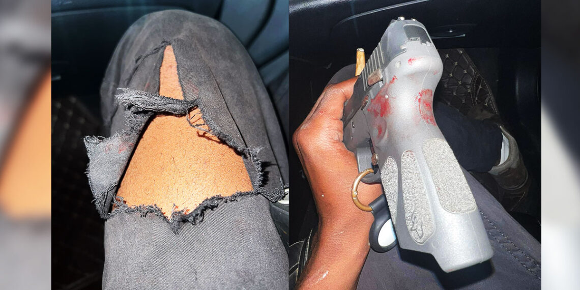 Man Puts Keys Into Pocket w/ Unholstered Gun...Guess What Happened Next?
