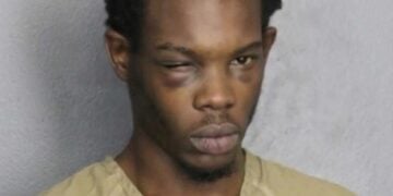 Fort Lauderdale Airbnb Renter Shoots 18-Year-Old Intruder in the Chest After Two Armed Men Break In at 6 P.M.